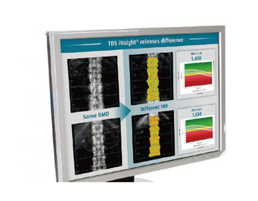 medimaps：TBS-iNsight